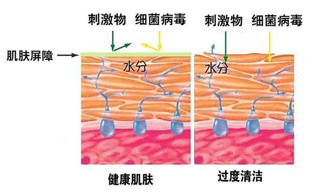 容易烂脸的十大洗面奶_http://www.zhaochafa.com_信息发布_第1张